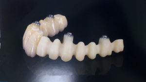 dental zirconia