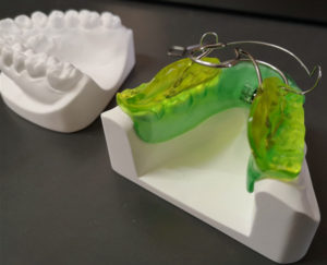 orthodontic appliance bionator