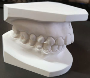 orthodontic study model